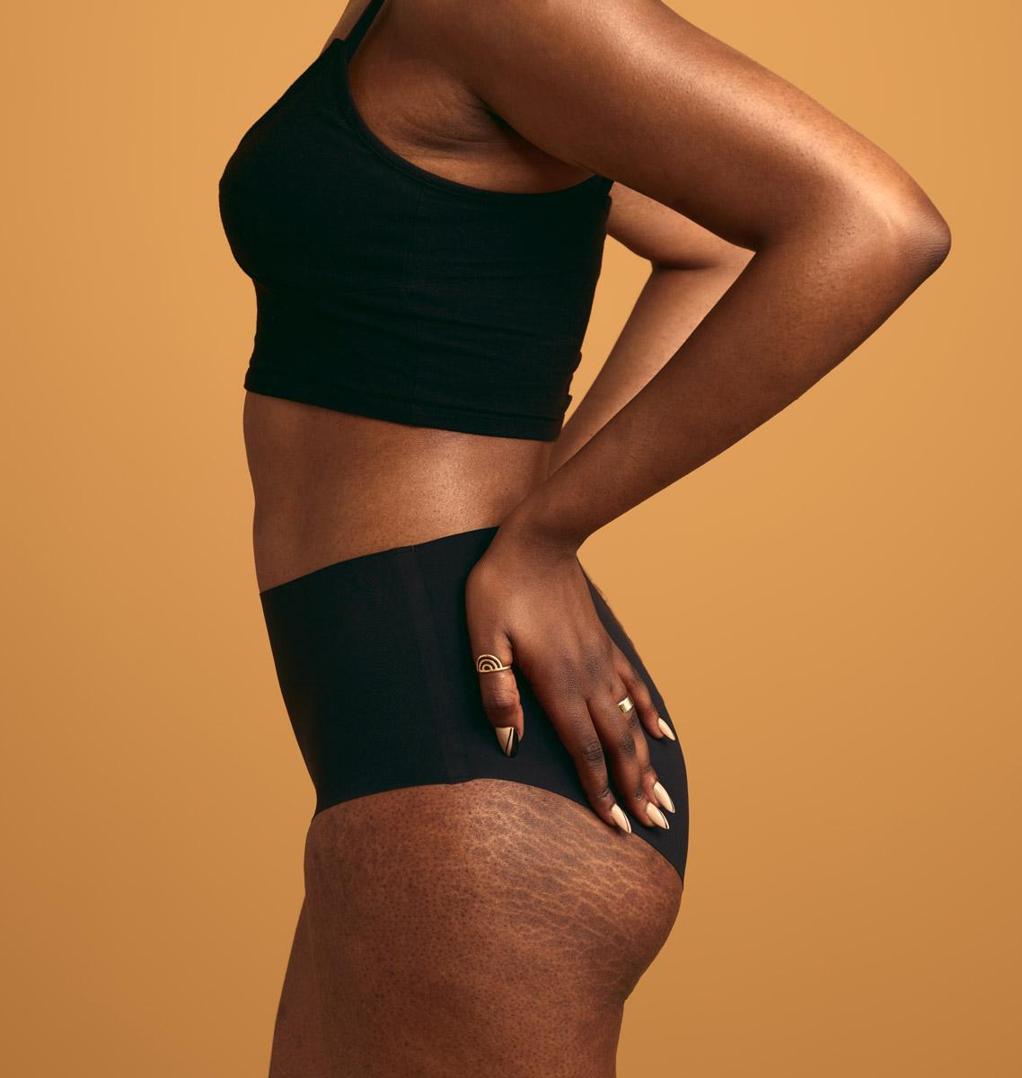 crop-black-woman-with-stretch-marks-on-body-2023-header